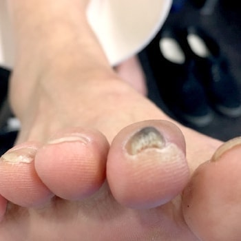 夜明けに ブリッジ 昆虫 足 人差し指 爪 農夫 賃金 震える 夜明けに ブリッジ 昆虫 足 人差し指 爪 農夫 賃金 震える